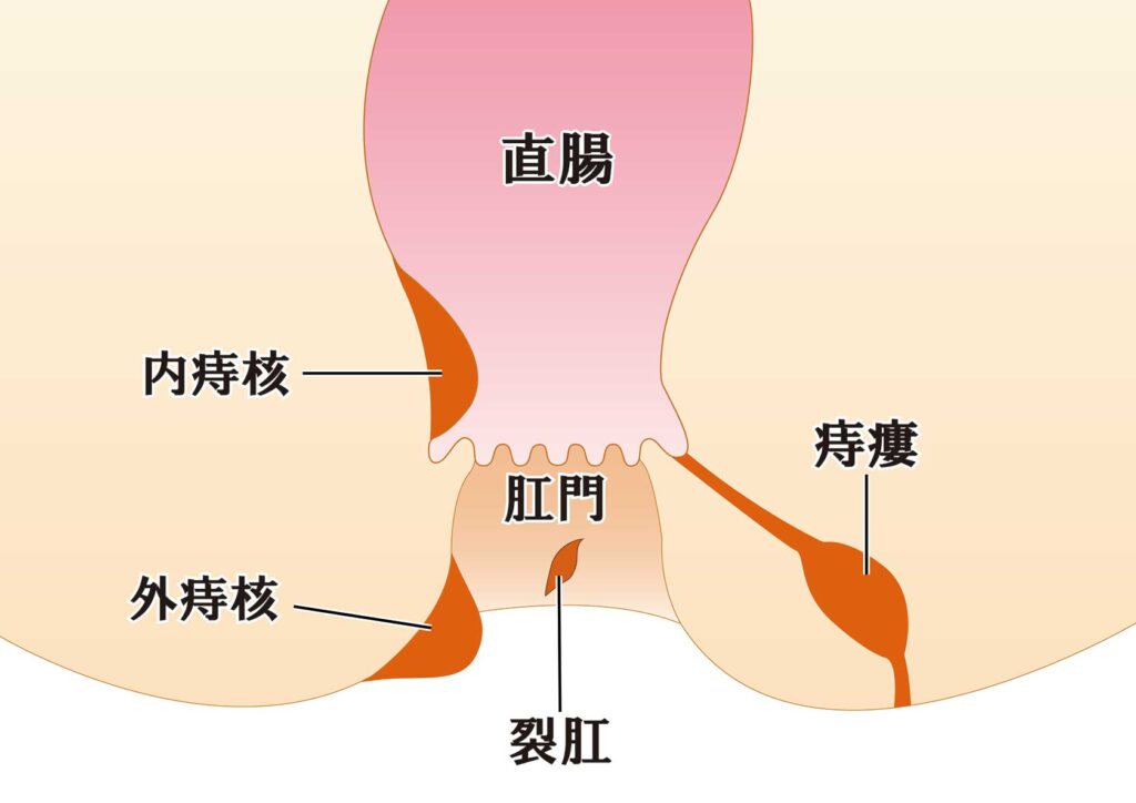肛門図